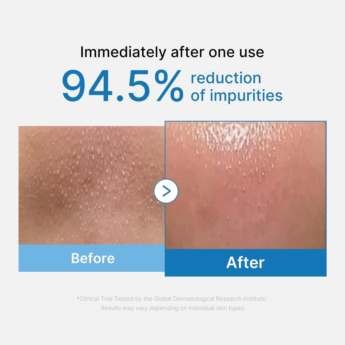medicube Zero Pore Blackhead Mud Mask — front of the tube